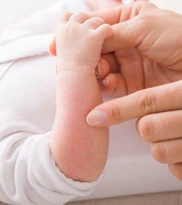Braço de um bebé deitado seguro por mãos de adulto que mostram uma alergia infantil na pele